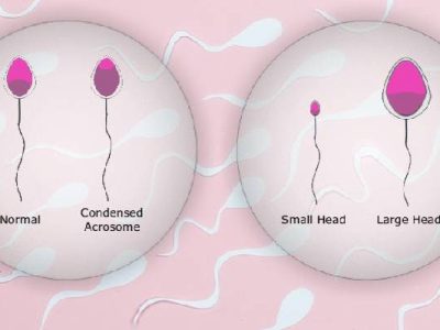 semen-analysis semen-analysis
